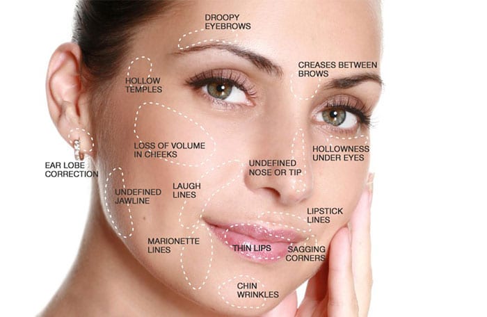 Dermal Fillers